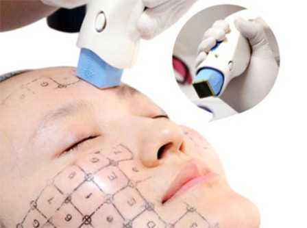 热玛吉 操作示意.jpg